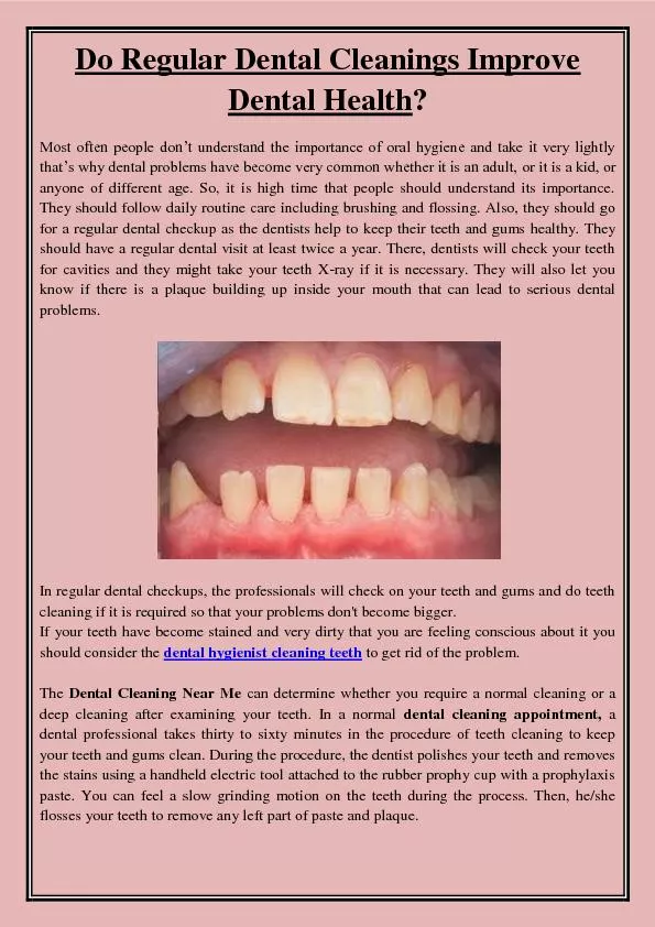 Do Regular Dental Cleanings Improve Dental Health?