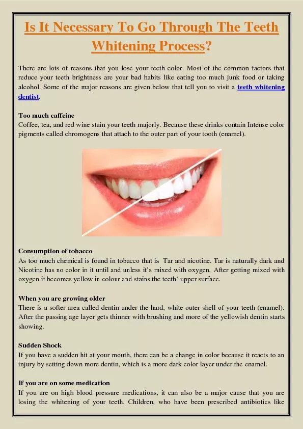 Is It Necessary To Go Through The Teeth Whitening Process?