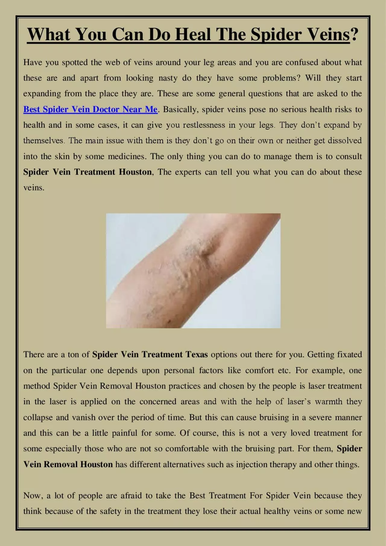 PDF-What You Can Do Heal The Spider Veins?