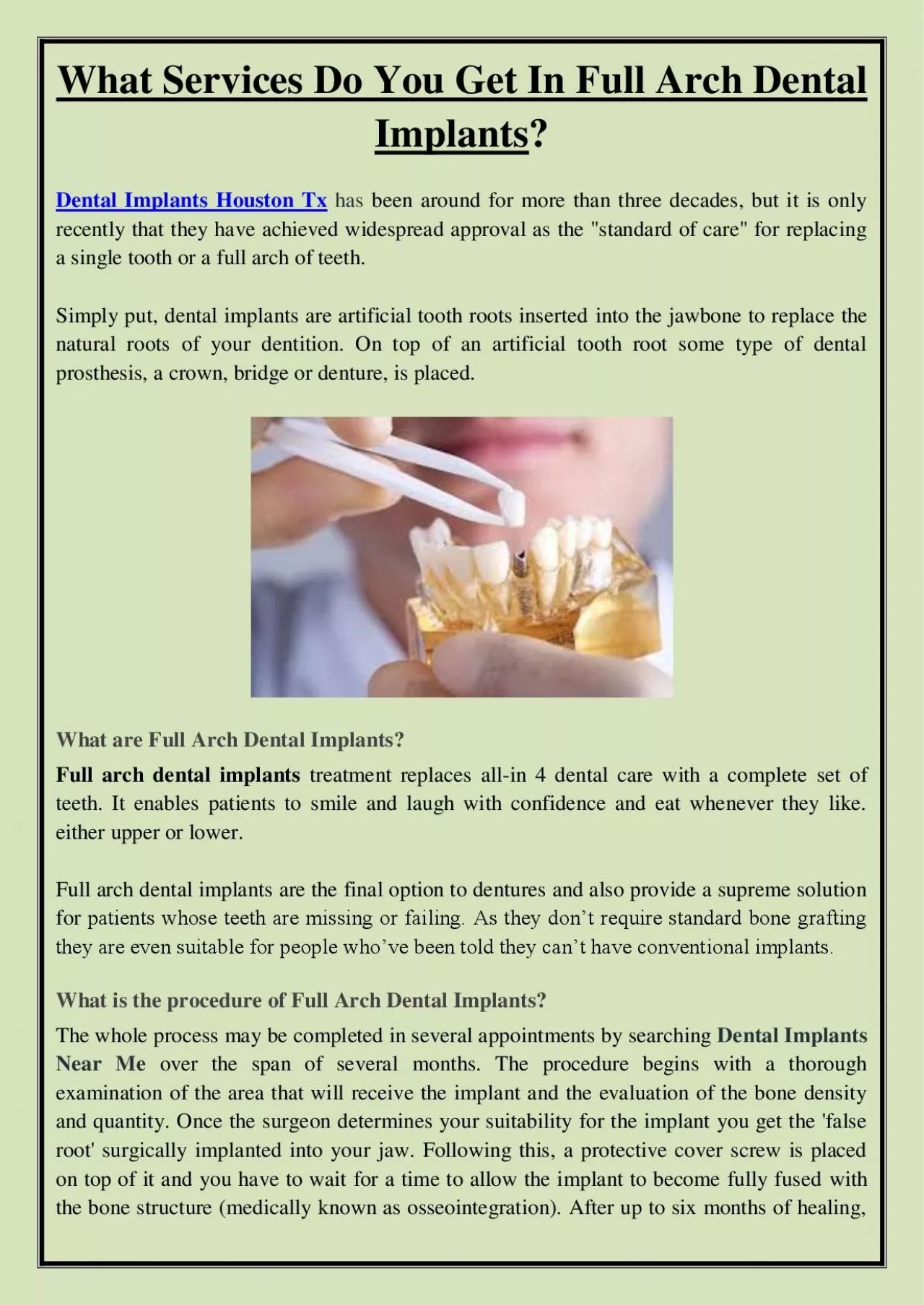 PDF-What Services Do You Get In Full Arch Dental Implants?