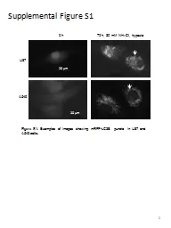 PPT-1 Supplemental Figure S1