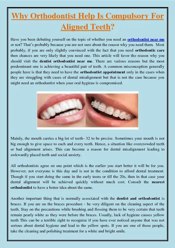 Why Orthodontist Help Is Compulsory For Aligned Teeth?