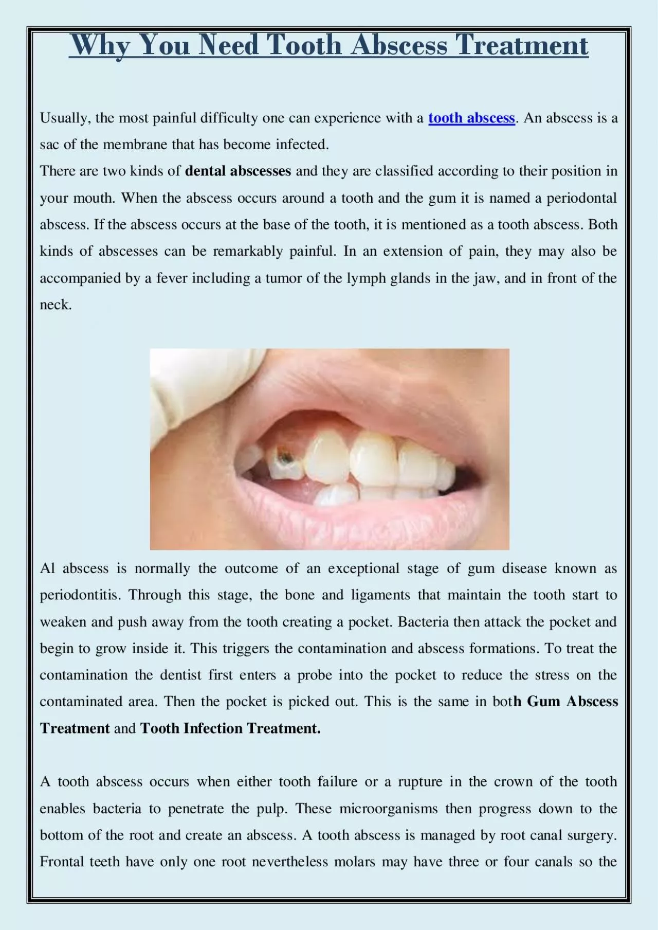 PDF-Why you need tooth abscess treatment