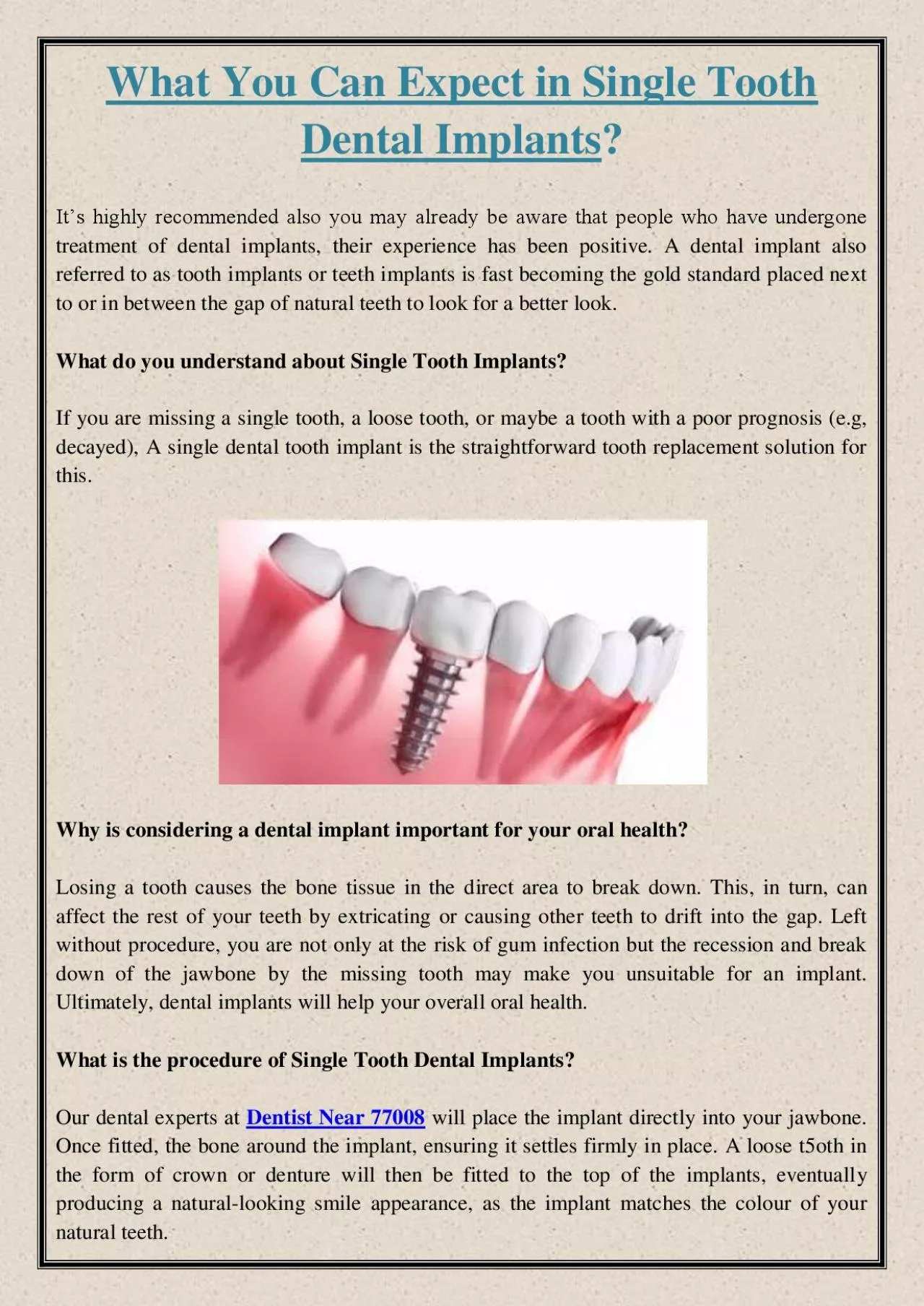 PDF-What You Can Expect in Single Tooth Dental Implants?