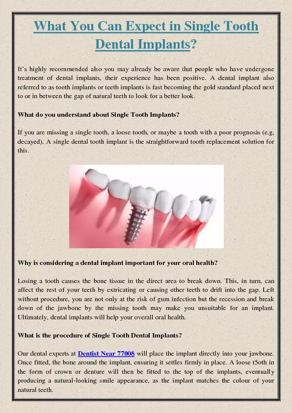 What You Can Expect in Single Tooth Dental Implants?