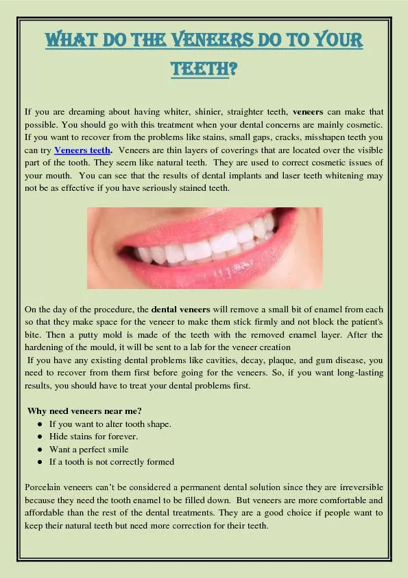 What Do The Veneers Do To Your Teeth?