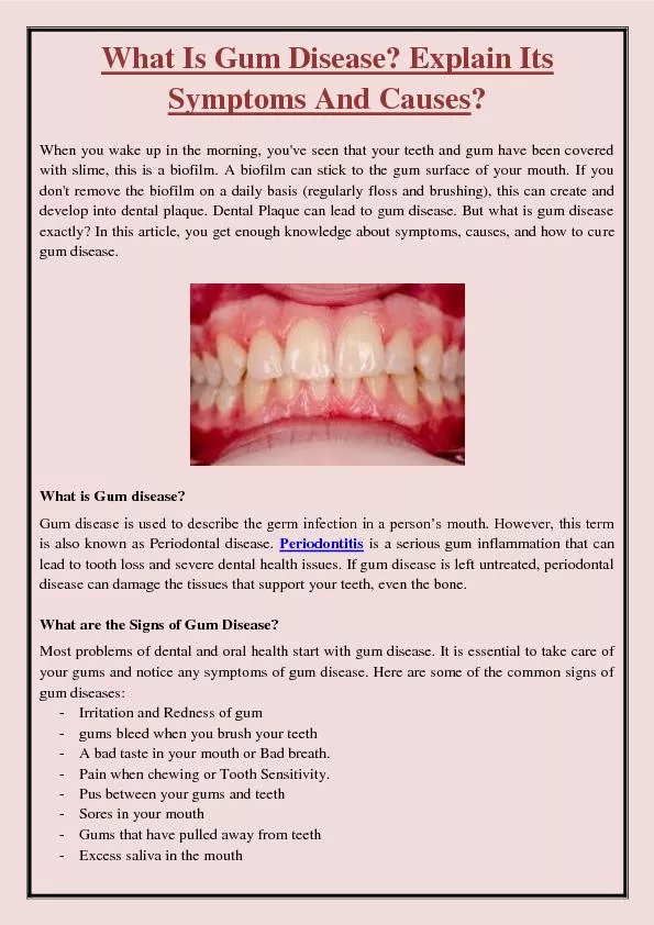 What Is Gum Disease? Explain Its Symptoms And Causes?