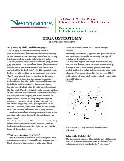 DEGAԆSTEOTOMY