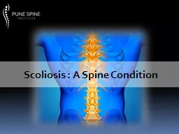Scoliosis : A Spine Condition
