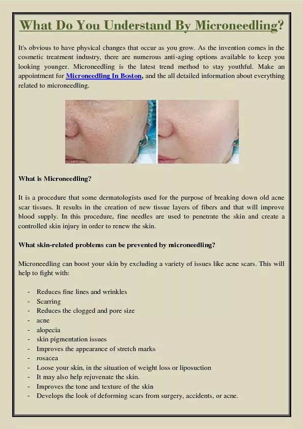 What Do You Understand By Microneedling?
