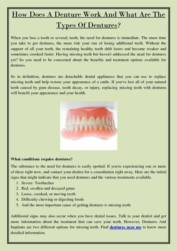 How Does A Denture Work And What Are The Types Of Dentures?