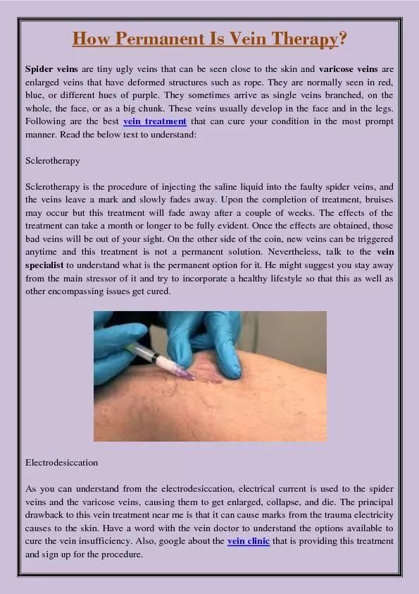 How Permanent Is Vein Therapy?