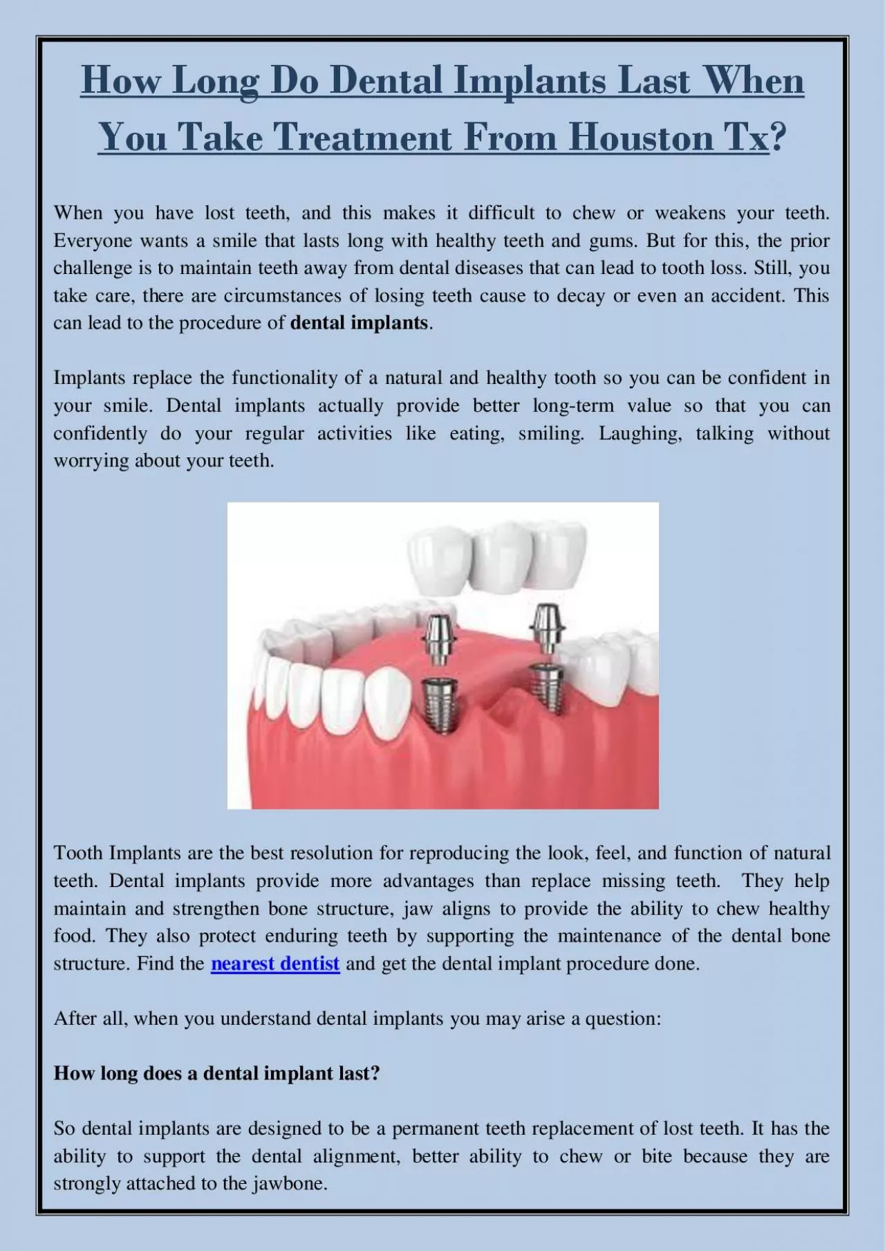 PDF-How Long Do Dental Implants Last When You Take Treatment From Houston Tx?