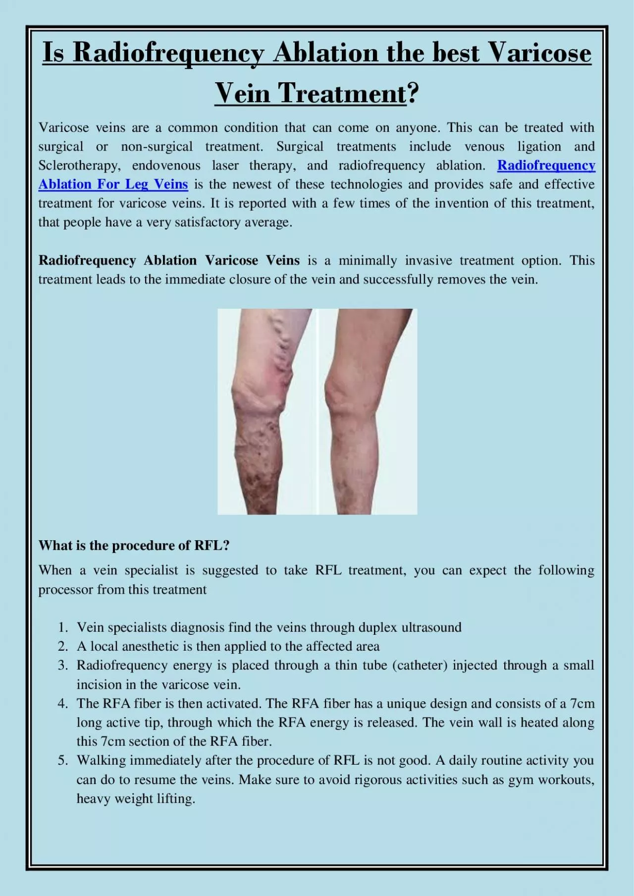 PDF-Is Radiofrequency Ablation the best Varicose Vein Treatment?