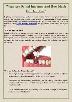 What Are Dental Implants And How Much Do They Cost?