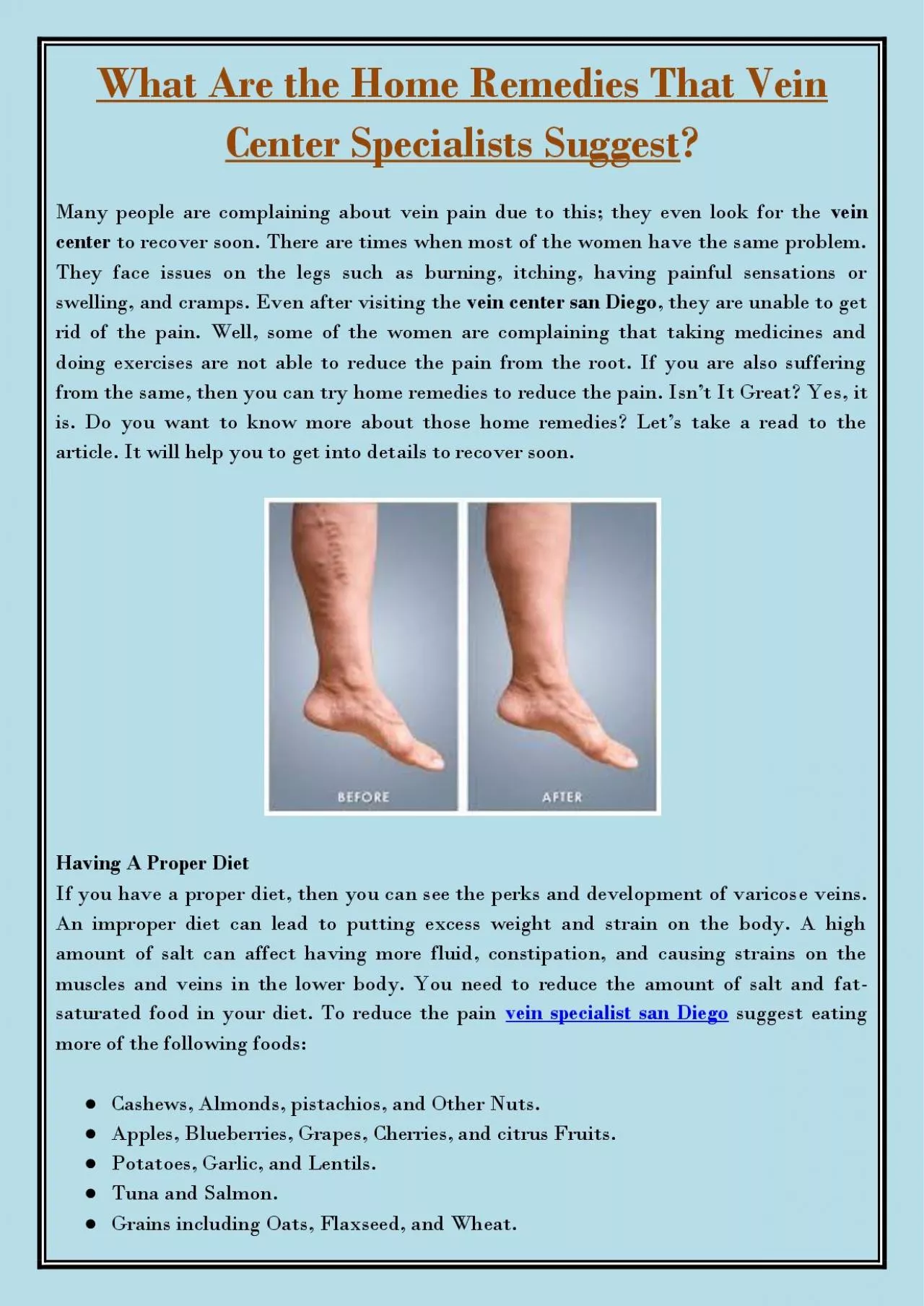 PDF-What Are the Home Remedies That Vein Center Specialists Suggest?