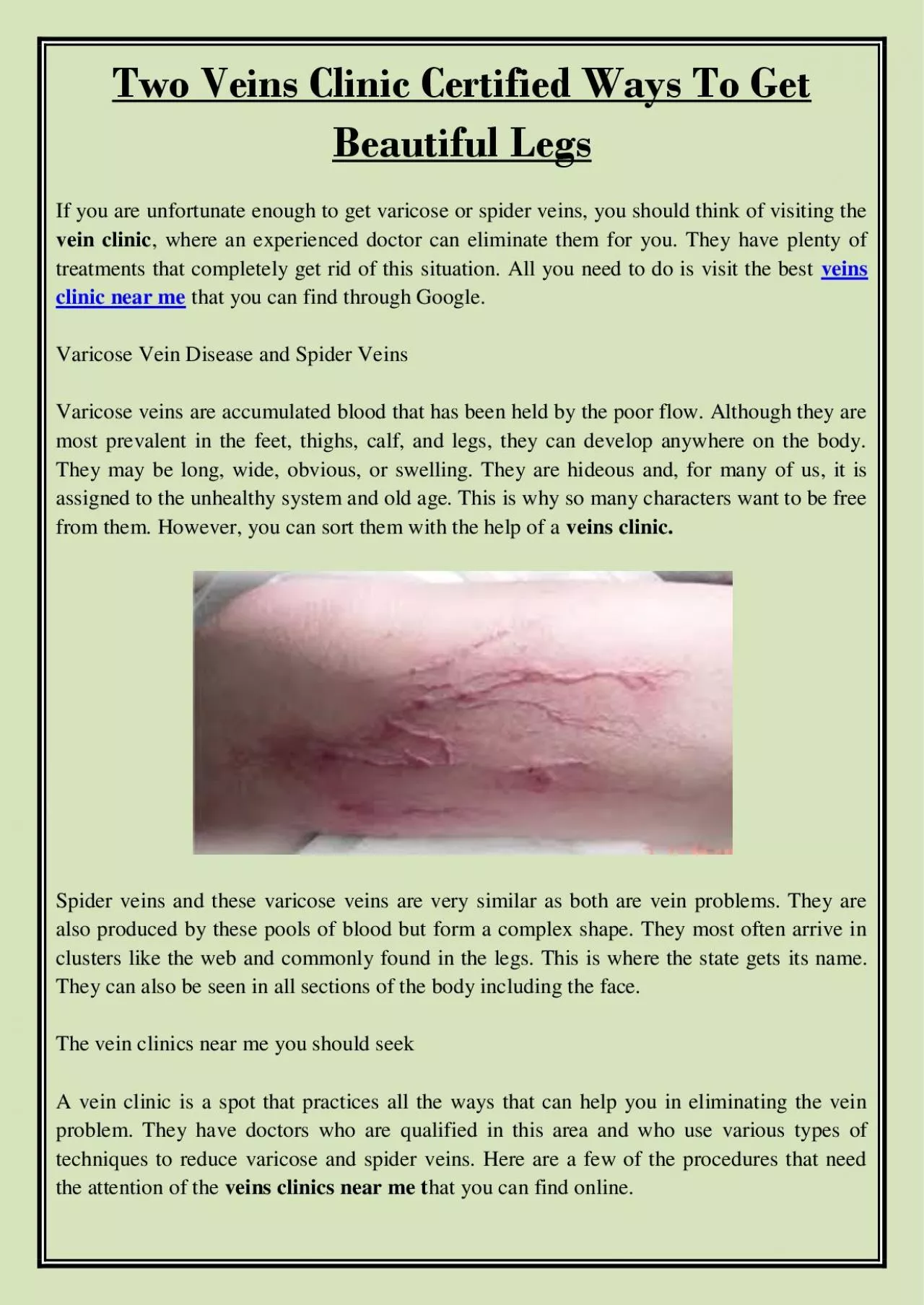 PDF-Two Veins Clinic Certified Ways To Get Beautiful Legs