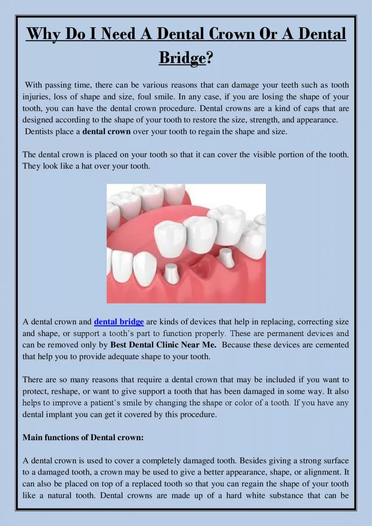 PDF-Why Do I Need A Dental Crown Or A Dental Bridge?