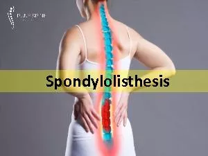 Spondylolisthesis Treatment in Pune