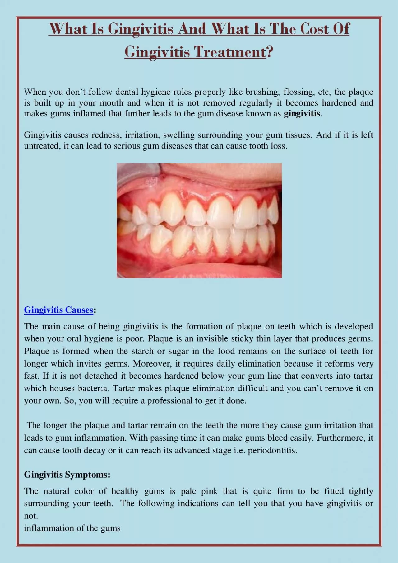 PDF-What Is Gingivitis And What Is The Cost Of Gingivitis Treatment?