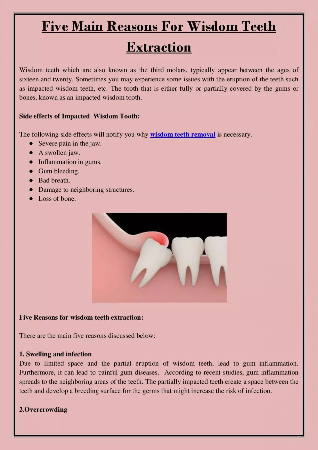 PDF-Five Main Reasons For Wisdom Teeth Extraction