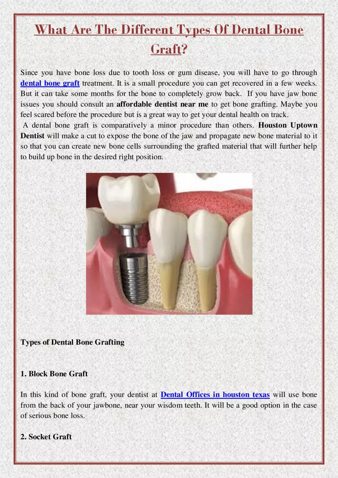 PDF-What Are The Different Types Of Dental Bone Graft?