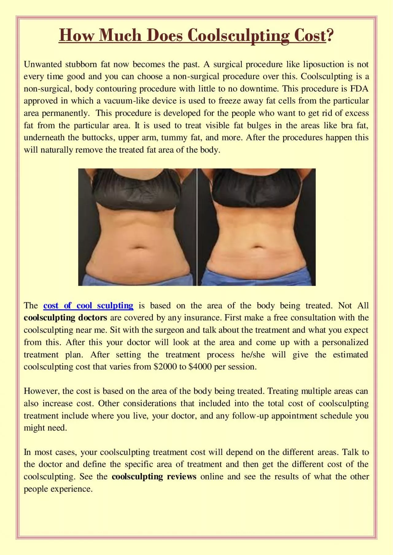 PDF-How Much Does Coolsculpting Cost?