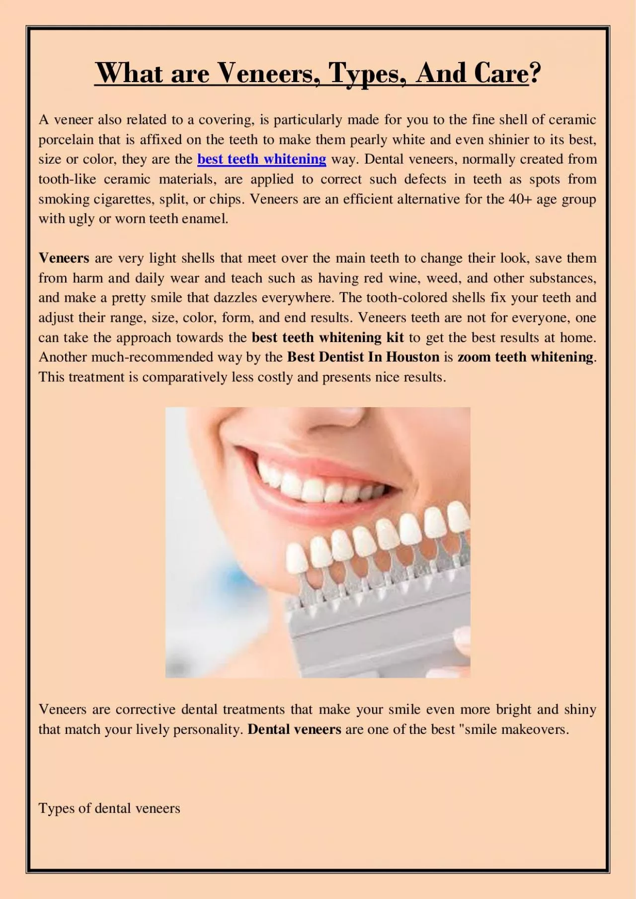 PDF-What are Veneers, Types, And Care?