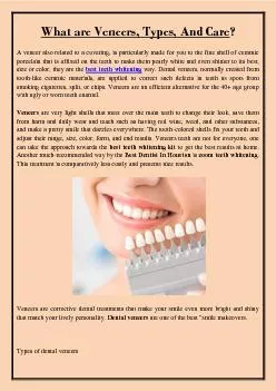What are Veneers, Types, And Care?