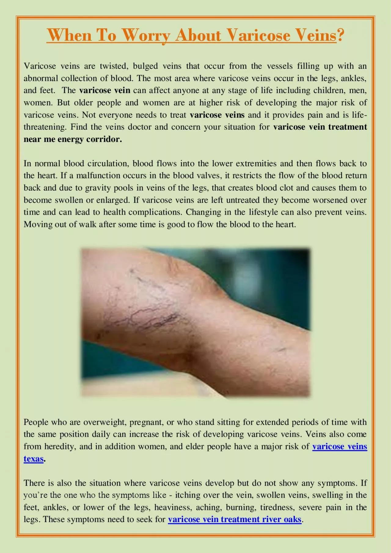 PDF-When To Worry About Varicose Veins?