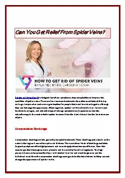 Can you get relief from spider veins