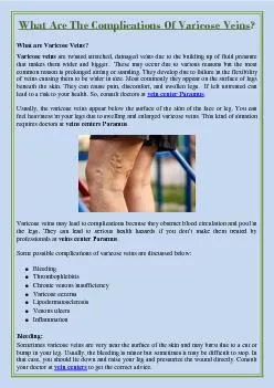What Are The Complications Of Varicose Veins?