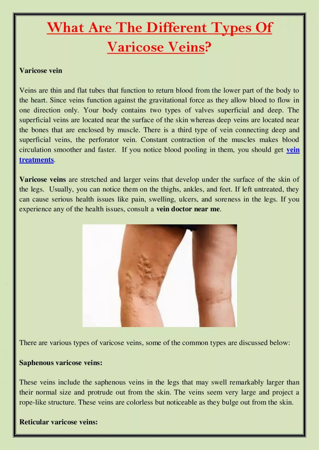 PDF-What Are The Different Types Of Varicose Veins?