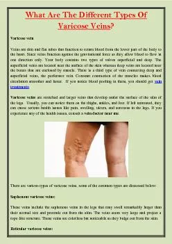 What Are The Different Types Of Varicose Veins?