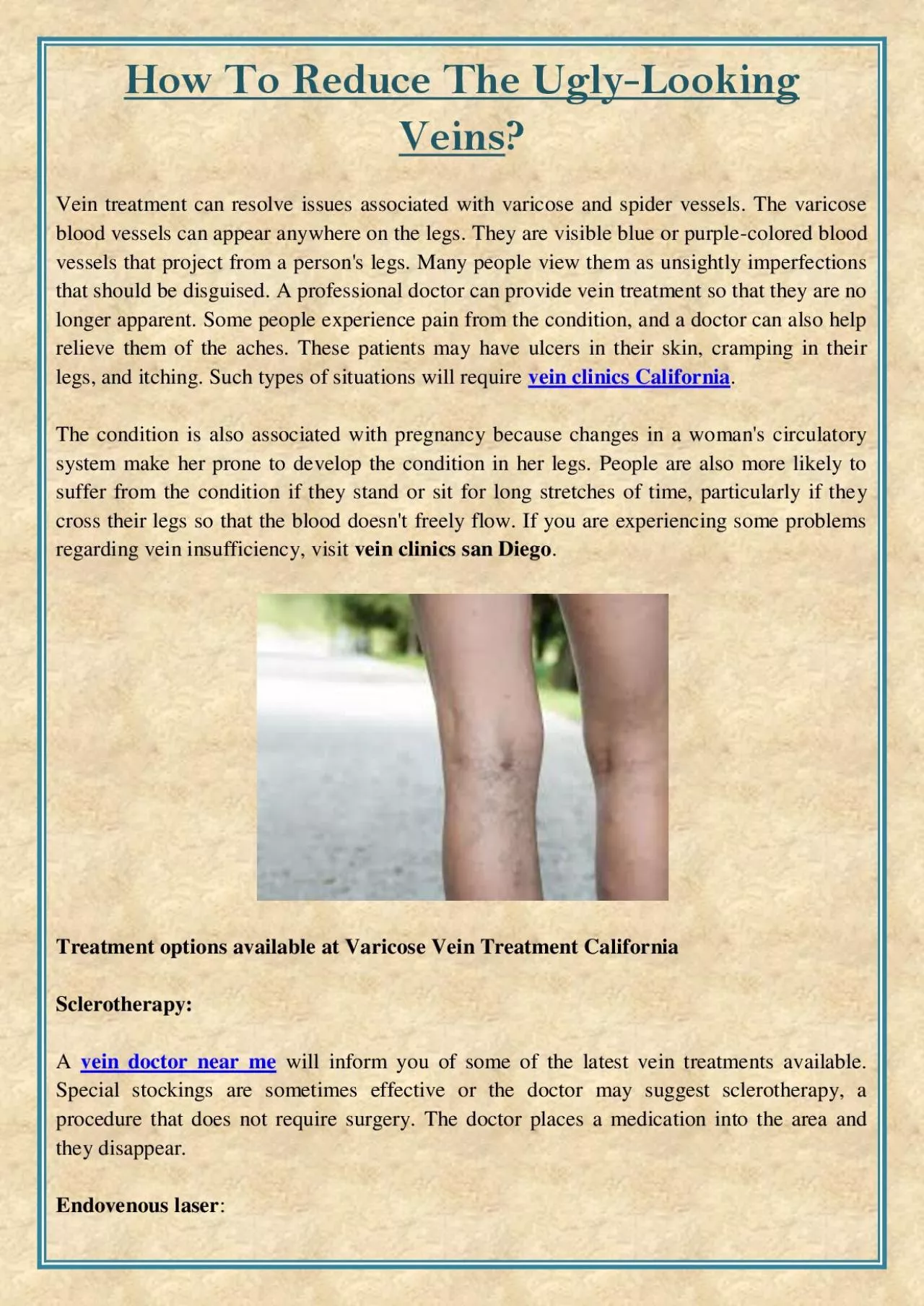 PDF-How To Reduce The Ugly-Looking Veins?