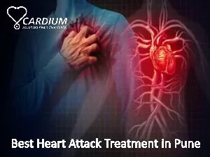 Best Heart Attack Treatment in Mumbai