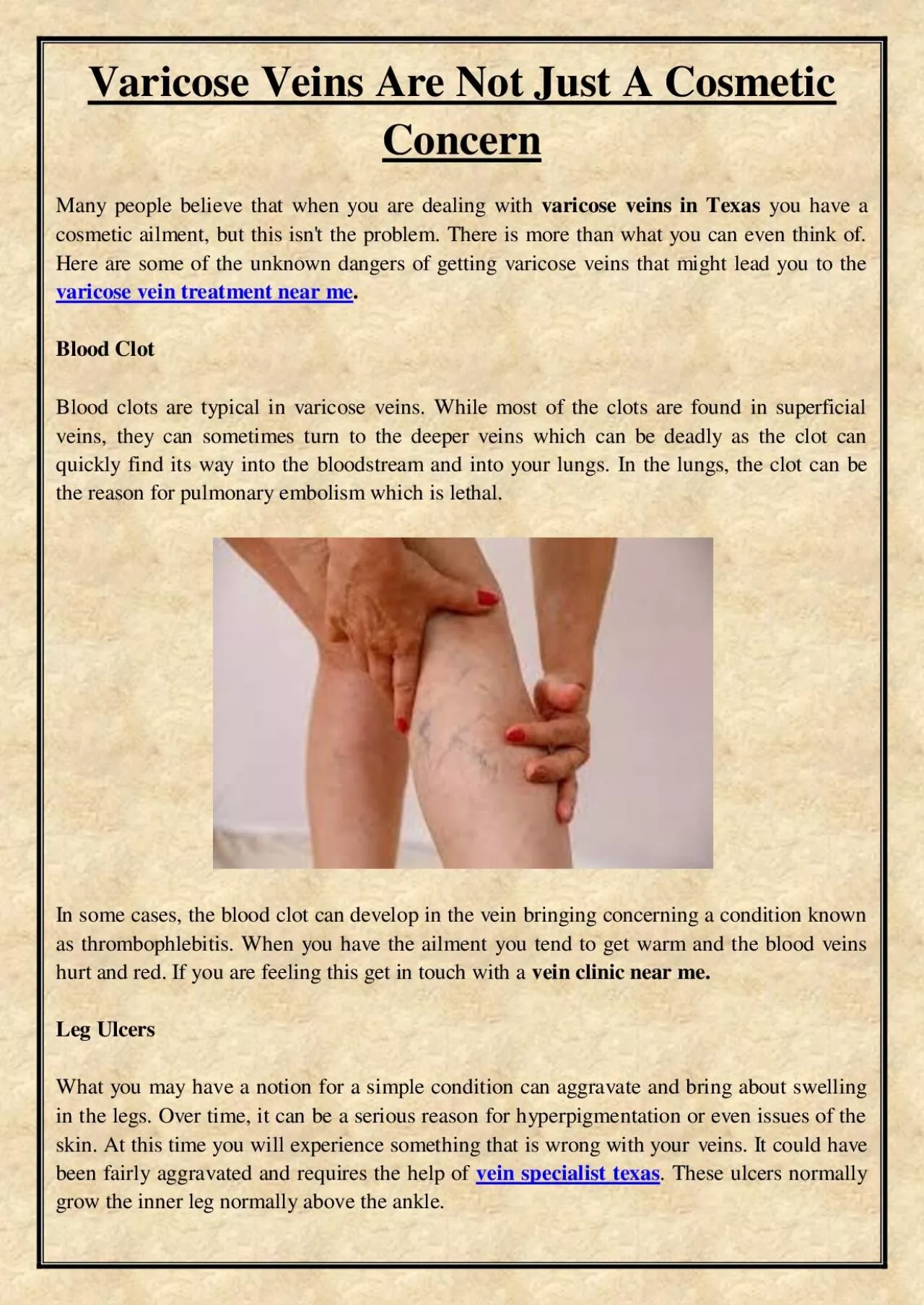 PDF-Varicose Veins Are Not Just A Cosmetic Concern