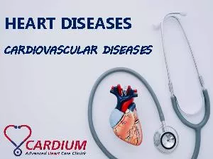Heart Disease – Types, Causes, Symptoms and Treatments