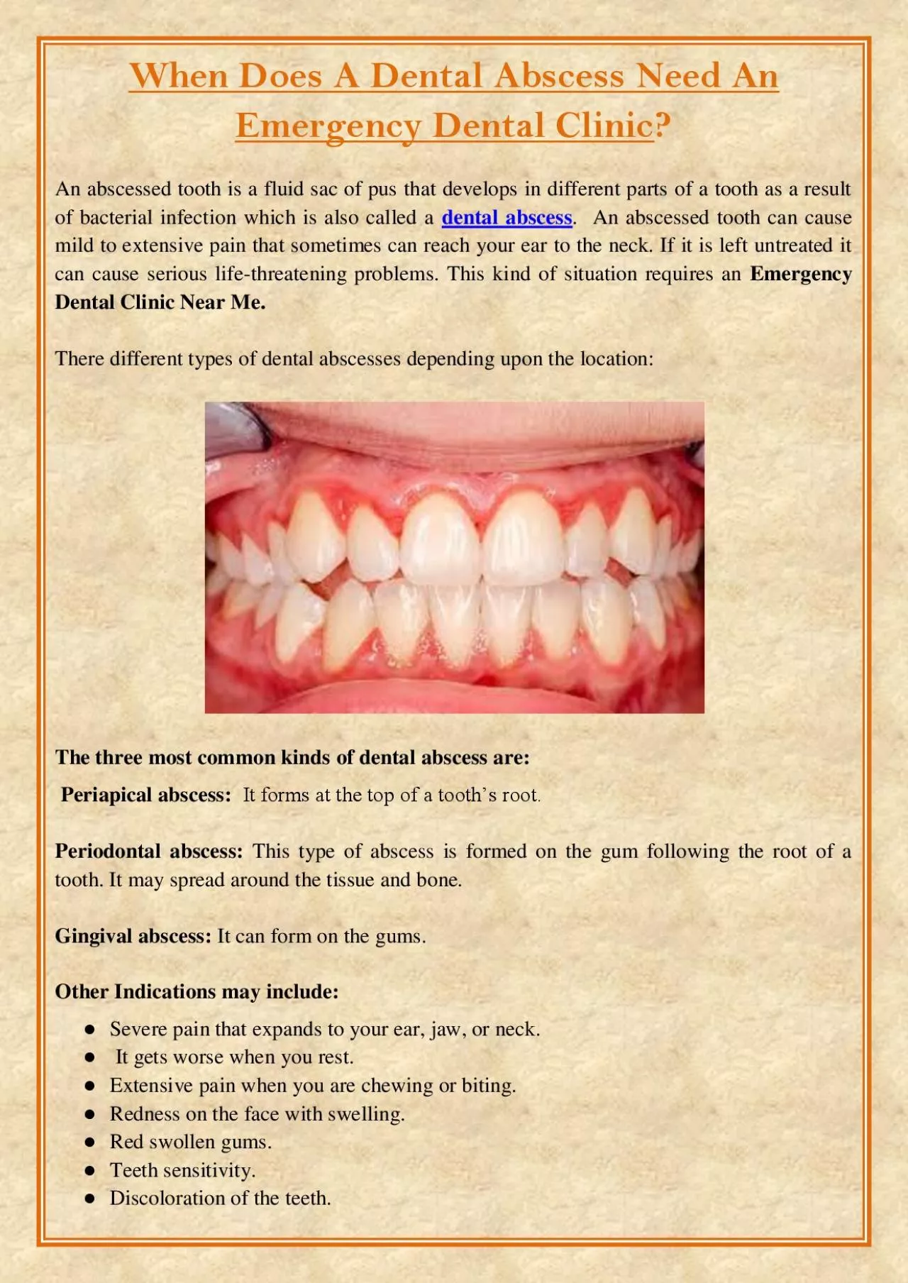 PDF-When Does A Dental Abscess Need An Emergency Dental Clinic?