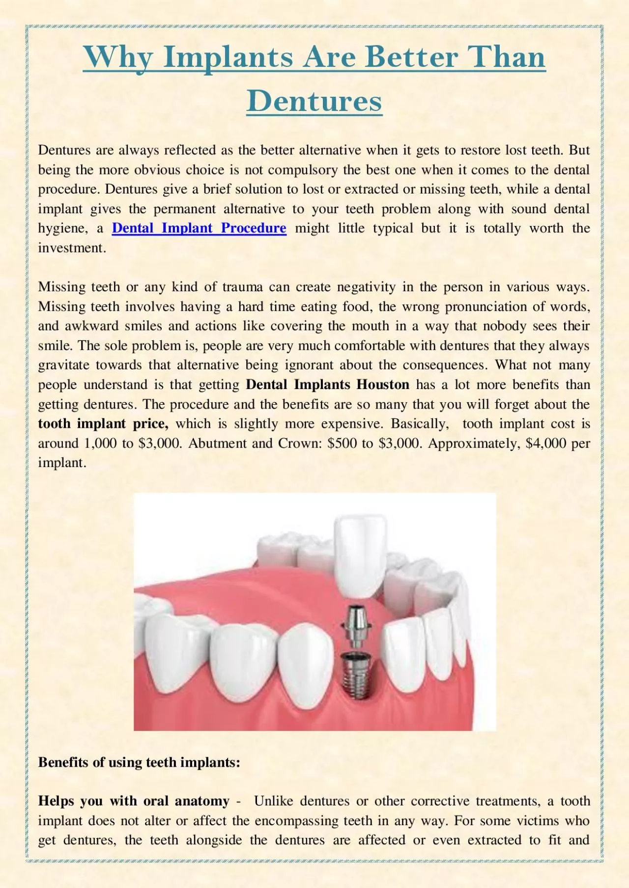 PDF-Why Implants Are Better Than Dentures