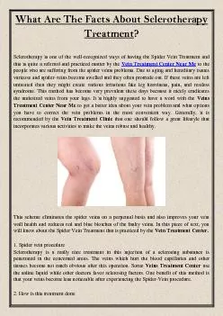 What Are The Facts About Sclerotherapy Treatment?