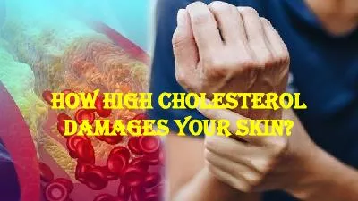 How High Cholesterol Damages Your Skin?