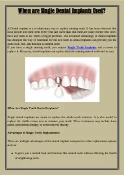 When are Single Dental Implants Used?