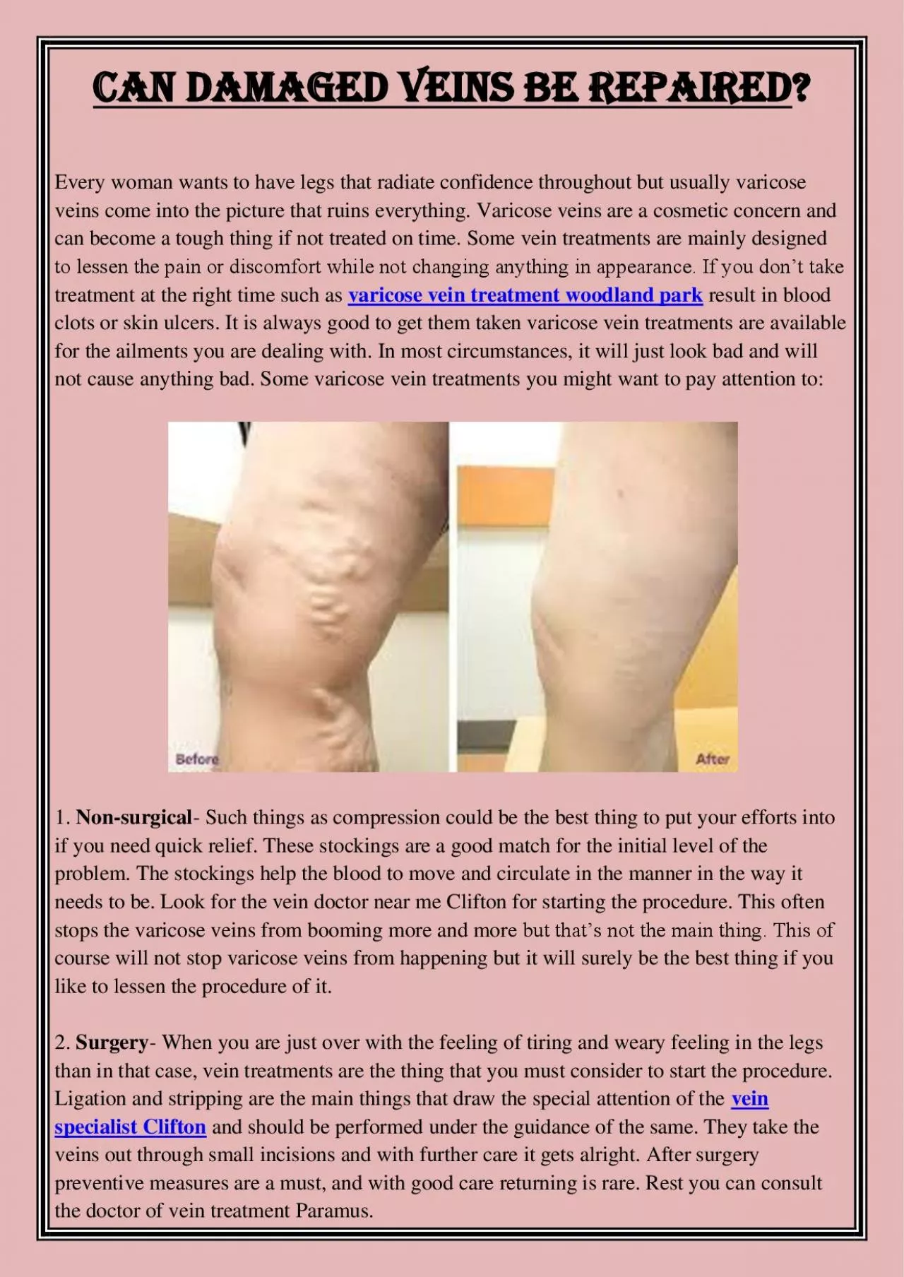 PDF-Can damaged veins be repaired?