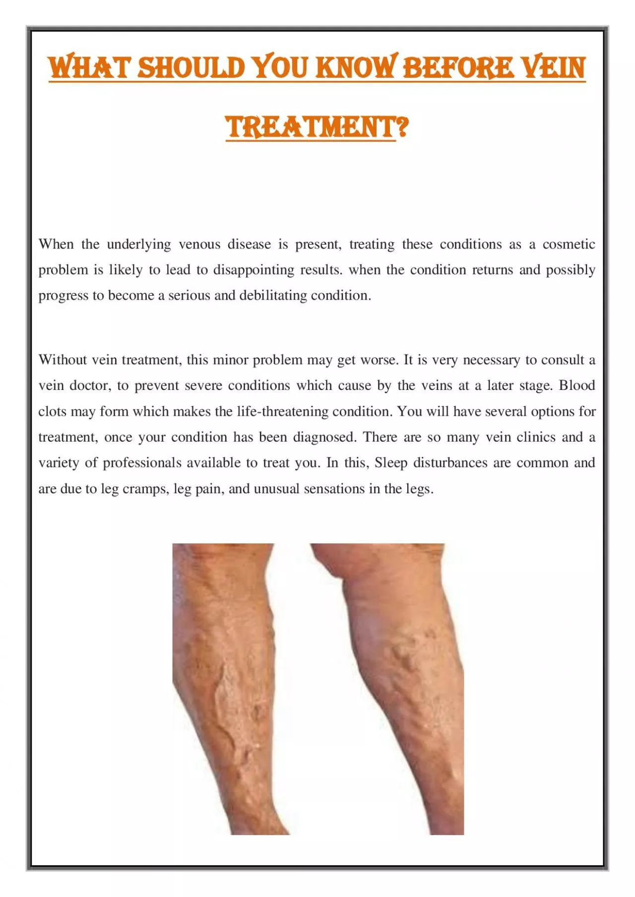 PDF-What should you know before Vein Treatment?