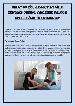 What Do You Expect At Vein Centers During Varicose Vein Or Spider Vein Treatments?