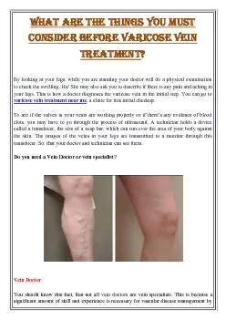 What are the things you must consider before varicose vein treatment?
