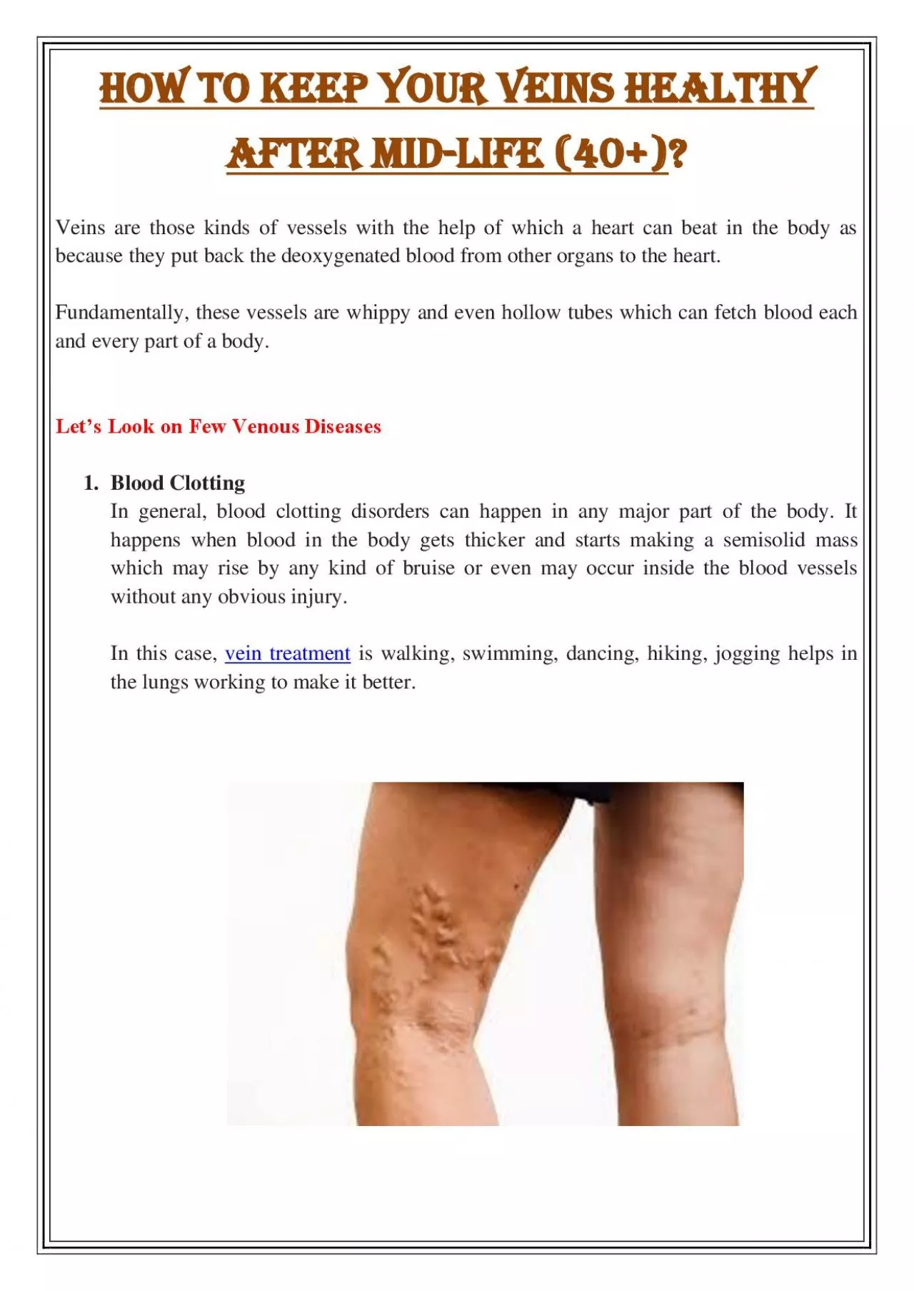 PDF-How To Keep Your Veins Healthy After Mid-life (40+)?