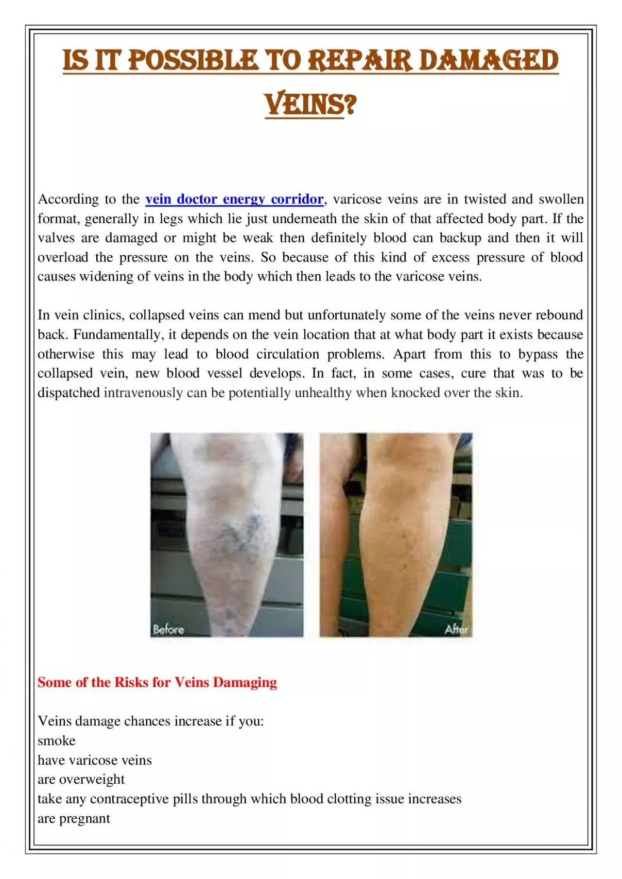 PDF-Is It Possible to Repair Damaged Veins?