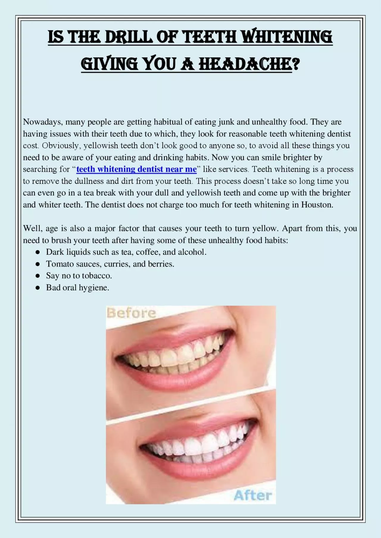 PDF-Is the drill of Teeth Whitening Giving you a Headache?